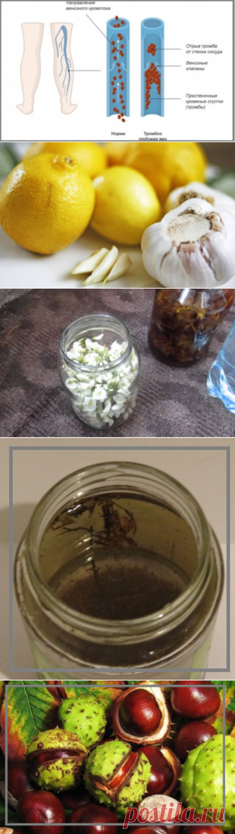 4 лучших народных средства, которые помогут  избежать  опасного заболевания тромбоза | моя записная книжка | Яндекс Дзен
