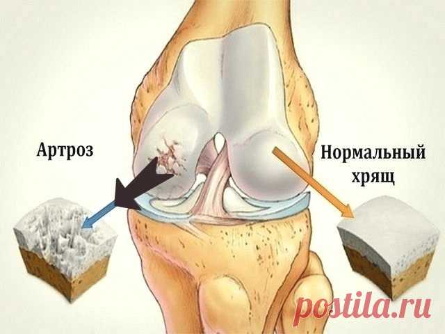KAK BEPHУTЬ CУCTABAM MOЛOДOCTЬ: ДOMAШHИЙ HAПИTOK, KOTOPЫЙ CHOBA CДEЛAET ПOXOДKУ ЛETЯЩEЙ