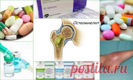Линкомицин при лечении остеомиелита