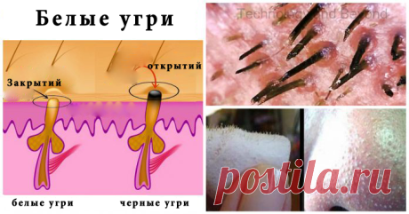 Избавиться от черных точек.