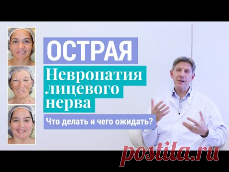 ***Паралич Белла: Что делать и чего ожидать при острой невропатии (неврите) лицевого нерва