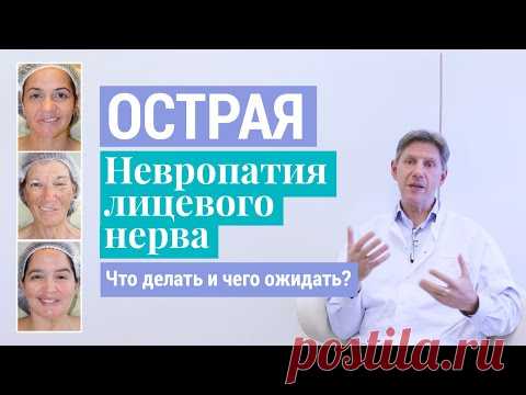 ***Паралич Белла: Что делать и чего ожидать при острой невропатии (неврите) лицевого нерва