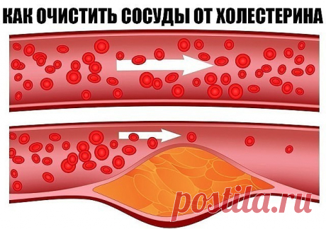 Очищаем сосуды от холестерина в домашних условиях.
1. Покупаем в аптеке цветки липы. Измельчаем их в кофемолке. И Ежедневно 3 раза в день принимаем по 1ч ложке порошка, запивая теплой водой. Курс длится 1 месяц. Вы не только снизите уровень холестерина в крови, выведите шлаки из организма, но и одновременно потеряете пару килограммов лишнего веса.
2. Обычная фасоль творит чудеса. Вечером заливаем полстакана фасоли или гороха и оставляем на ночь. Утром воду сливаем, заменяе...