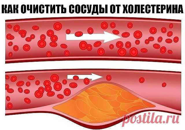 Очищаем сосуды от холестерина в домашних условиях.
1. Покупаем в аптеке цветки липы. Измельчаем их в кофемолке. И Ежедневно 3 раза в день принимаем по 1ч ложке порошка, запивая теплой водой. Курс длится 1 месяц. Вы не только снизите уровень холестерина в крови, выведите шлаки из организма, но и одновременно потеряете пару килограммов лишнего веса.
2. Обычная фасоль творит чудеса. Вечером заливаем полстакана фасоли или гороха и оставляем на ночь. Утром воду сливаем, заменяе...