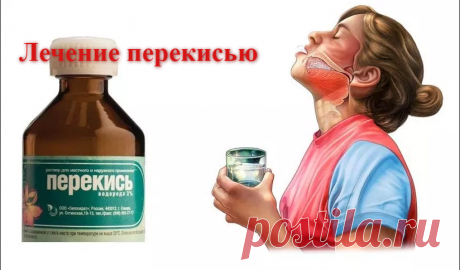 Быстрая остановка кровотечения и дезинфекция с помощью 1 простого ингредиента