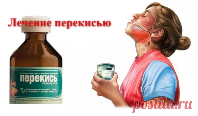 Быстрая остановка кровотечения и дезинфекция с помощью 1 простого ингредиента