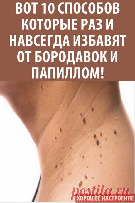 Вот 10 способов которые раз и навсегда избавят от бородавок и папиллом!