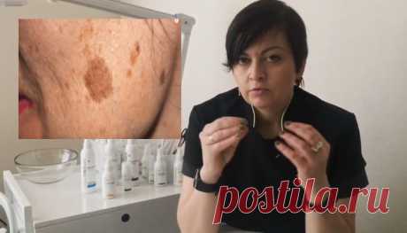 КАК ВЫВЕСТИ КОРИЧНЕВЫЕ ПЯТНА НА КОЖЕ ЛИЦА — Домашние заботы