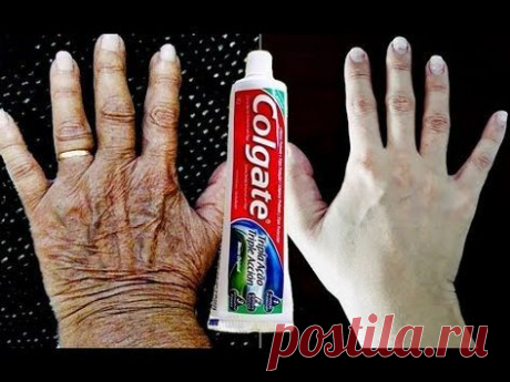 USE 1 Vez e EXPULSE 30 ANOS de MANCHAS e RUGAS Das Mãos! - YouTube