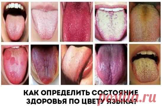 (24) Одноклассники