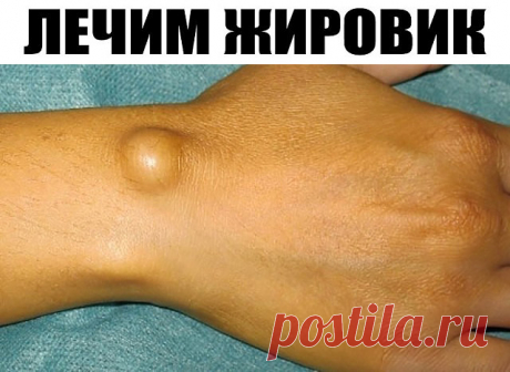 (86) Одноклассники