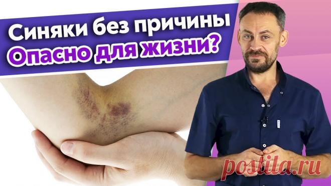 Как быстро убрать гематому? / Синяки и гематомы на теле 🔺 Онлайн-курс 