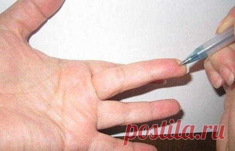 (37) Одноклассники