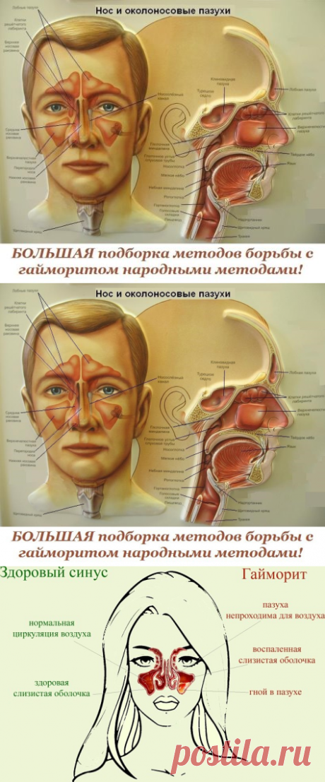 (38) Одноклассники