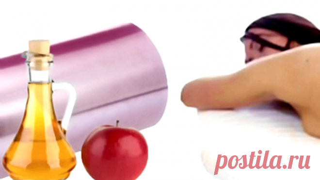 Лечение миомы в домашних условиях народными средствами