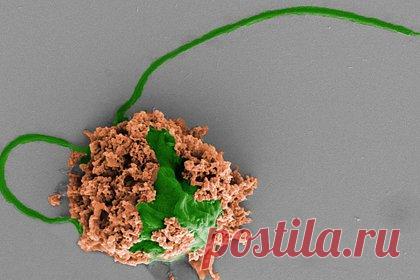 Разработаны микророботы для лечения пневмонии. Ученые Калифорнийского университета в Сан-Диего разработали микроскопических роботов, которые могут плавать в легких, доставлять лекарственные препараты и использоваться для лечения бактериальной пневмонии. В ходе экспериментов микророботы уничтожали вызывающие пневмонию бактерии в легких мышей.