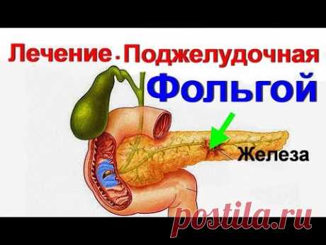 Фольга. Лечение поджелудочной железы фольгой. Поджелудочная и селезенка. Панкреатит. А ты это знал?