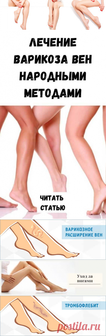 Наиболее распространенными народными методами лечения варикозной болезни вен нижних конечностей до настоящего времени остаются гирудотерапия (или лечение варикоза пиявками), фитотерапия (траволечение), контрастные ножные ванны, всевозможные мази и втирания и, безусловно диетотерапия.

Народные методы лечения варикоза · Варикозная болезнь