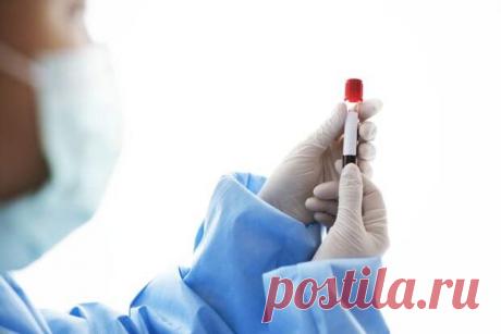 Мочевая кислота в крови: можно ли обойтись без лекарств? - ПолонСил.ру - социальная сеть здоровья - Медиаплатформа МирТесен В норме мочевая кислота растворяется в крови и удаляется почками, в меньшем количестве — кишечником. Ее избыток может долго оставаться незамеченным, но со временем способен привести к подагре, камням в почках и другим проблемам. Источник: https://ru.freepik.com Вместе с ревматологом разберем, что - 30 декабря - 43209658490 - Медиаплатформа МирТесен