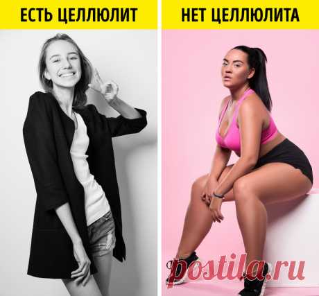 10 мифов о целлюлите, в которые мы до сих пор верим