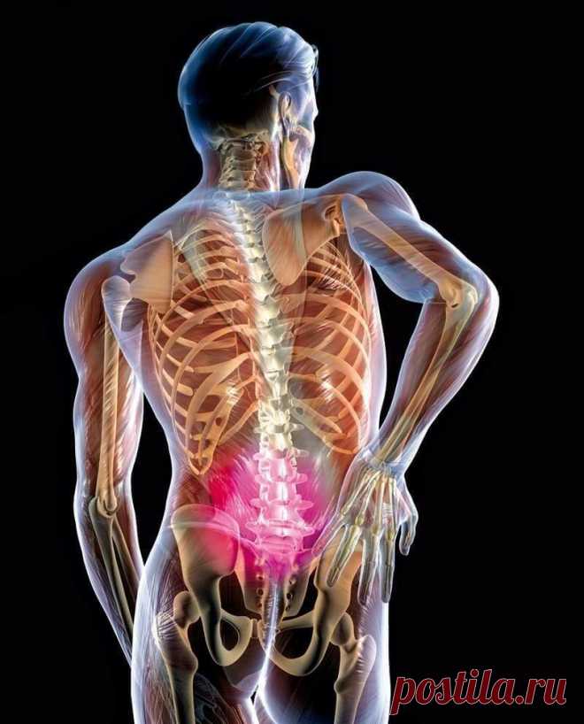 Защемление седалищного нерва: 2 простых упражнения, которые помогут