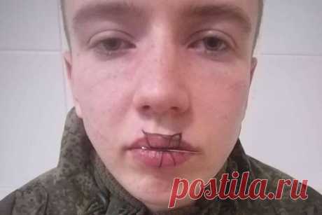 Российский солдат зашил себе рот после ссоры с девушкой. 19-летний российский солдат-срочник решил наказать себя за грубые слова в отношении девушки и зашил себе рот. Отмечается, что инцидент произошел в городе Чебаркуль в Челябинской области в среду, 15 декабря. Молодой человек приревновал свою возлюбленную и накричал на нее.
