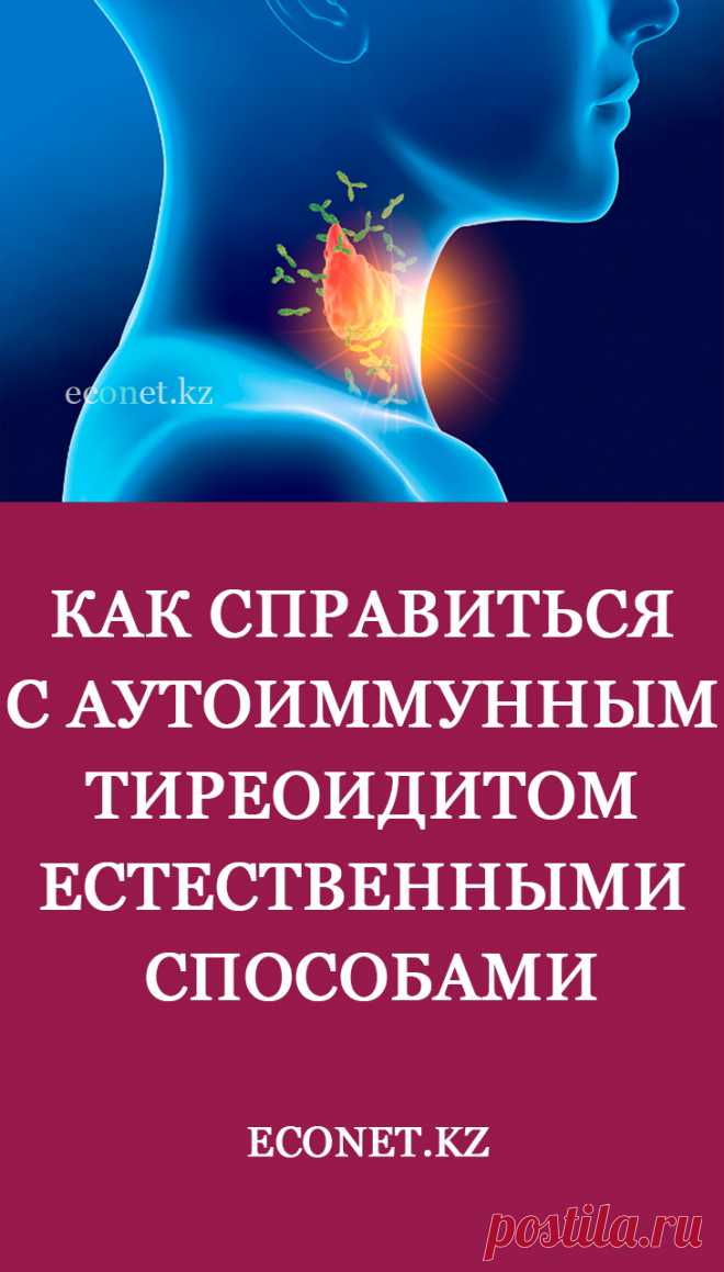 Как справиться с аутоиммунным тиреоидитом естественными способами

Хроническая усталость, раздражительность, появление лишних килограммов при обычном режиме питания – характерные симптомы эндокринных нарушений. Они могут указывать на патологии щитовидной железы, пониженную выработку основных гормонов. Кроме гипотиреоза, врачи предупреждают о хроническом лимфоцитарном тиреоидите, имеющем схожие признаки.