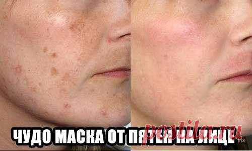 РЕЦЕПТ ОЧЕНЬ ЭФФЕКТИВНОЙ МАСКИ ОТ ЛЮБЫХ ПЯТЕН НА ЛИЦЕ