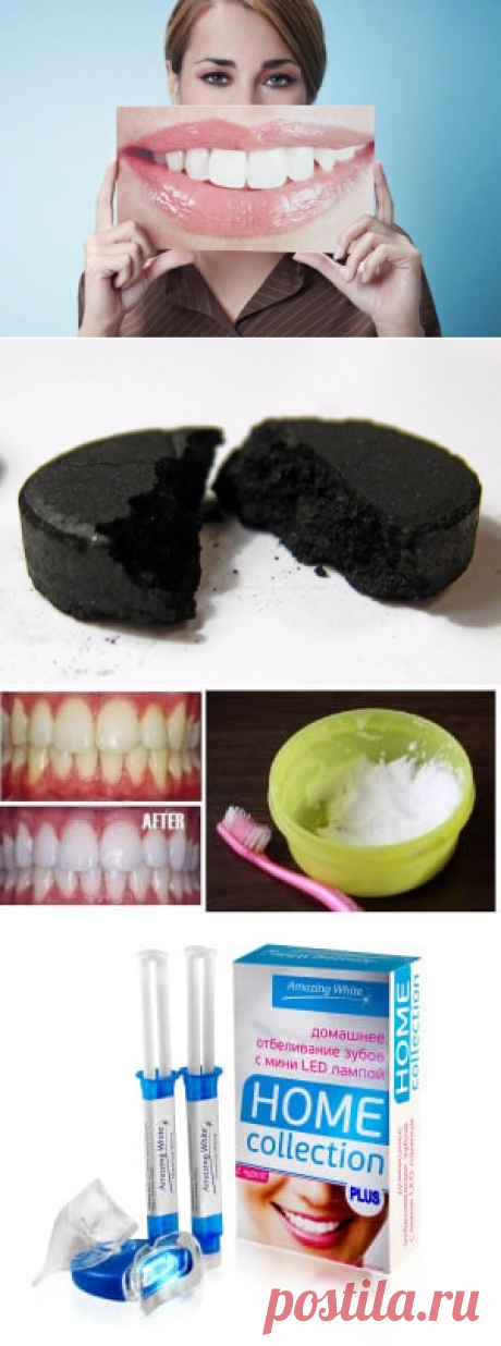 7 способов отбеливания зубов в домашних условиях
