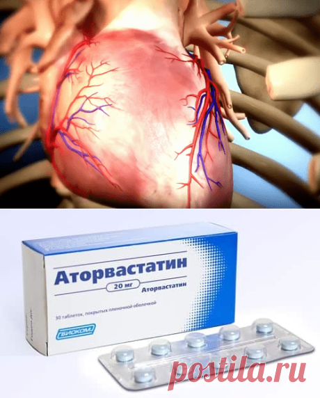 Статины: что это такое польза и вред для организма