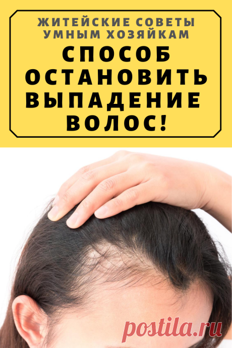 Способ остановить выпадение волос. Волосы действительно больше не выпадают! | Житейские Советы