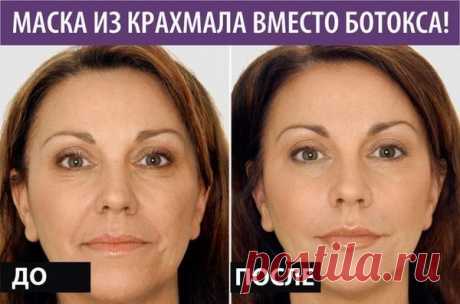 Крахмал избавит от морщин  Маска предназначена для зрелой кожи с признаками усталости.


Прибегнуть к уколам ботокса вы всегда успеете.
Вместо этого средства попробуйте маску на основе обычного крахмала. Знатоки говорят, что э…