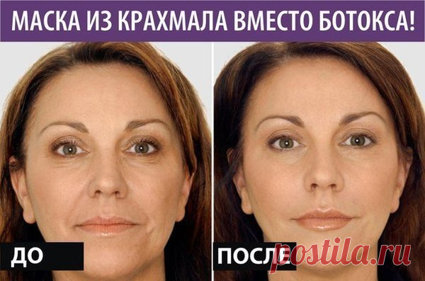 Крахмал избавит от морщин  Маска предназначена для зрелой кожи с признаками усталости.


Прибегнуть к уколам ботокса вы всегда успеете.
Вместо этого средства попробуйте маску на основе обычного крахмала. Знатоки говорят, что э…