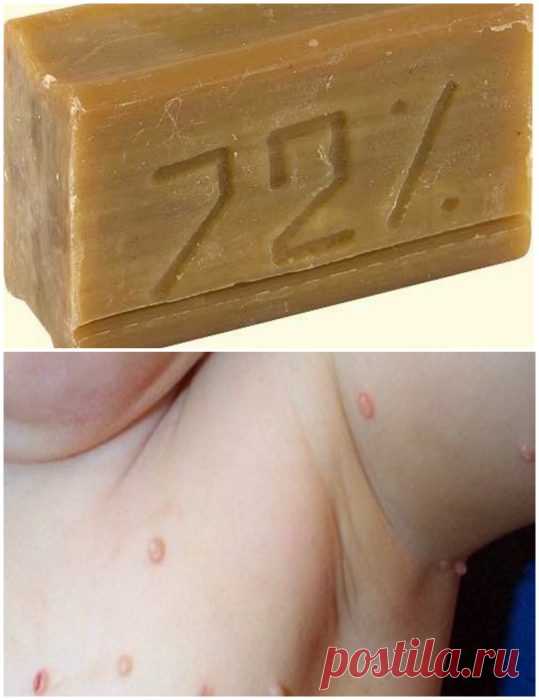Нестандартное использование хозяйственного мыла / Все для женщины