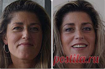 Как уменьшить нос упражнениями, исправить искривление носа? - Клуб молодости, красоты и здоровья