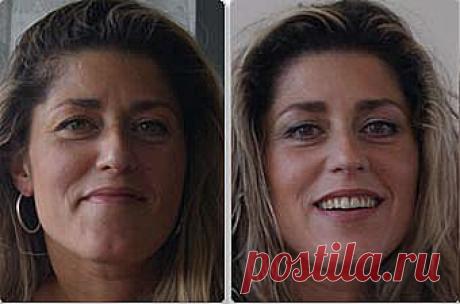 Как уменьшить нос упражнениями, исправить искривление носа? - Клуб молодости, красоты и здоровья