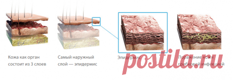Грибок стопы – симптомы, эффективное лечение грибка стопы, список недорогих препаратов