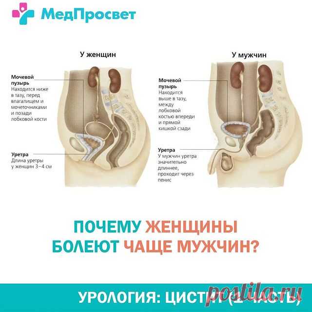 Photo shared by Клиника МедПросвет СПб 🏥 on July 05, 2021 tagging @urolog_spb_irychkov. May be an image of text that says 'медпросвет у женщин мочевой пузырь находится ниже перед влагалищем мочеточниками y мужчин мочевой лобковой кости находится тазу, между обковой костью впереди прямой кишкой сзади уретра длина уретры женщин CM уретра мужчинуретра значительно длиннее, проходит через пенис почему женщины болеют чаще мужчин? урология: цистит (1 часть)'.