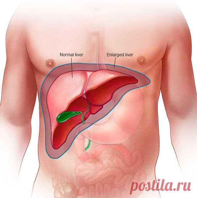 6 естественных санитаров печени - Калейдоскоп событий 6 естественных санитаров печени Некоторые продукты обладают прекрасными очищающими свойствами, которые помогут оздоровить организм естественным образом. В отличие от лекарственных препаратов, натуральные продукты не нагружают организм химическими веществами и бережно […]