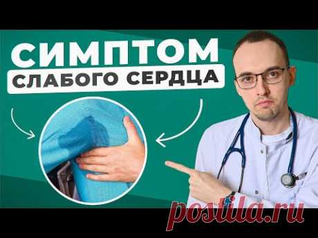 Как Предотвратить СЕРДЕЧНУЮ НЕДОСТАТОЧНОСТЬ И Укрепить Сердце В ДОМАШНИХ Условиях? Советы КАРДИОЛОГА