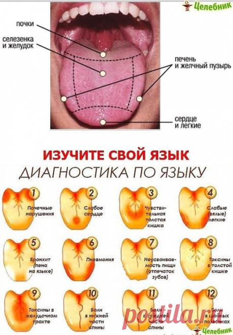 (58) Одноклассники