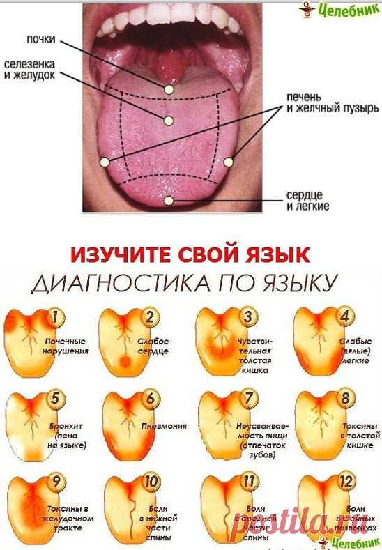 (58) Одноклассники