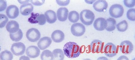 Благодаря участию добровольцев, стало известно много нового о возбудителях малярии и ранних этапах течения болезни – а ведь она постоянно угрожает по меньшей мере четырём миллиардам человек на планете!