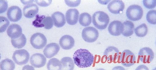 Благодаря участию добровольцев, стало известно много нового о возбудителях малярии и ранних этапах течения болезни – а ведь она постоянно угрожает по меньшей мере четырём миллиардам человек на планете!