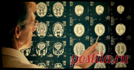 Умерли от Альцгеймера, а патологоанатомы у них нашли инфекции — провоцируют деменцию и преждевременное старение | Будь здоров | Дзен