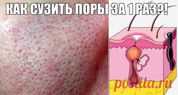 Фото Хроники - Моя территория: советы, рецепты, красота, уют