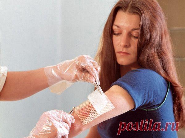 Нарывы, фурункулы, чирьи: народные средства лечения. | Советы Народной Мудрости