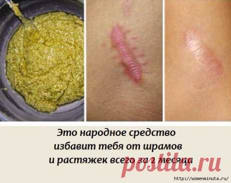 Мазь, которая сможет избавить Вас от шрамов и растяжек на коже.