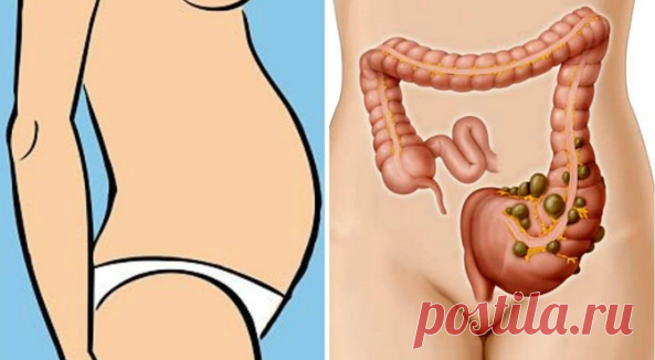 Вот почему вы страдаете от вздутия и как избавиться от него и от лишнего веса