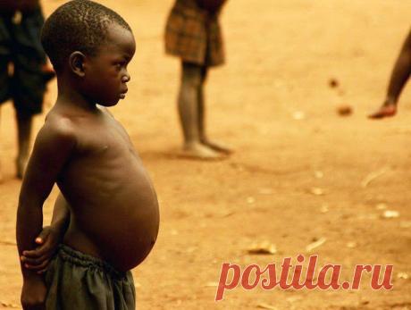 Почему у африканских детей большие животы | Краше Всех